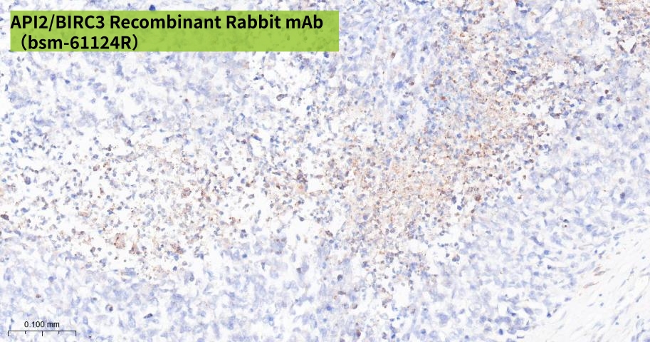 bsm-61124R Human Rhabdomyosarcoma_副本